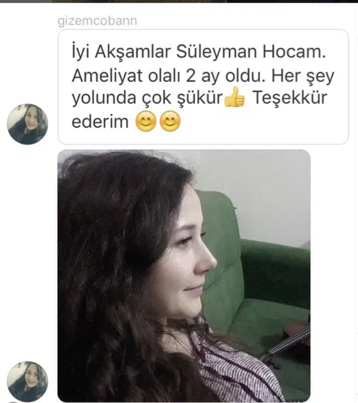 Suleyman Tas reviews – verified rhinoplasty patient review #327