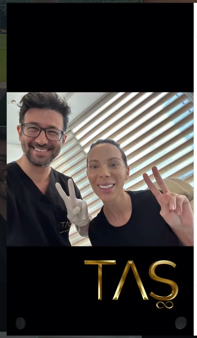 Suleyman Tas reviews – verified rhinoplasty patient review #36