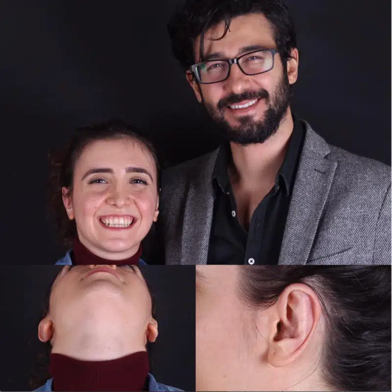 Suleyman Tas reviews – verified plastic surgery patient review #249