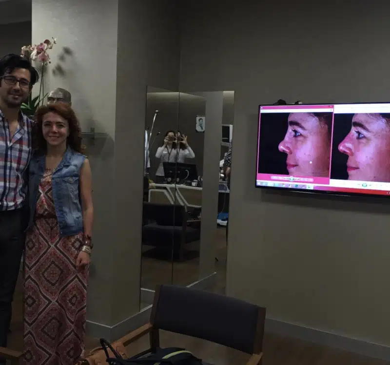 Suleyman Tas reviews – verified rhinoplasty patient review #307