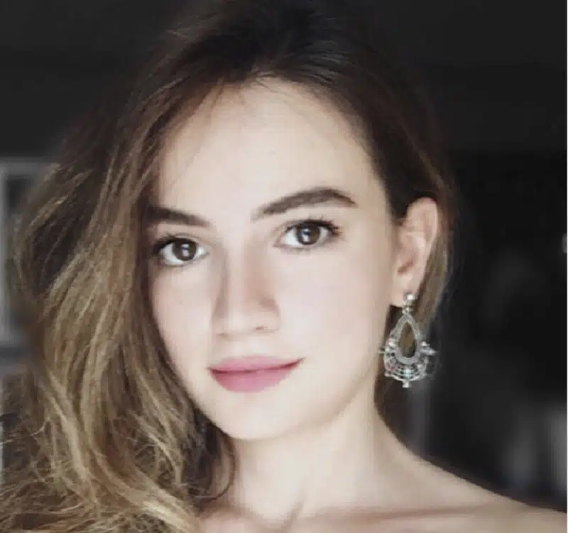 Suleyman Tas reviews – verified rhinoplasty patient review #202