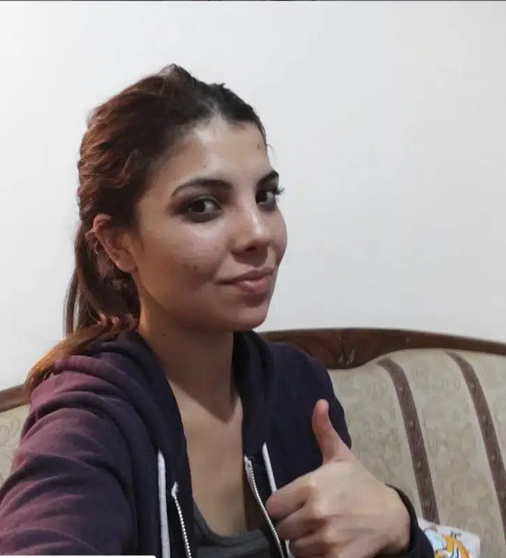 Suleyman Tas reviews – verified rhinoplasty patient review #377