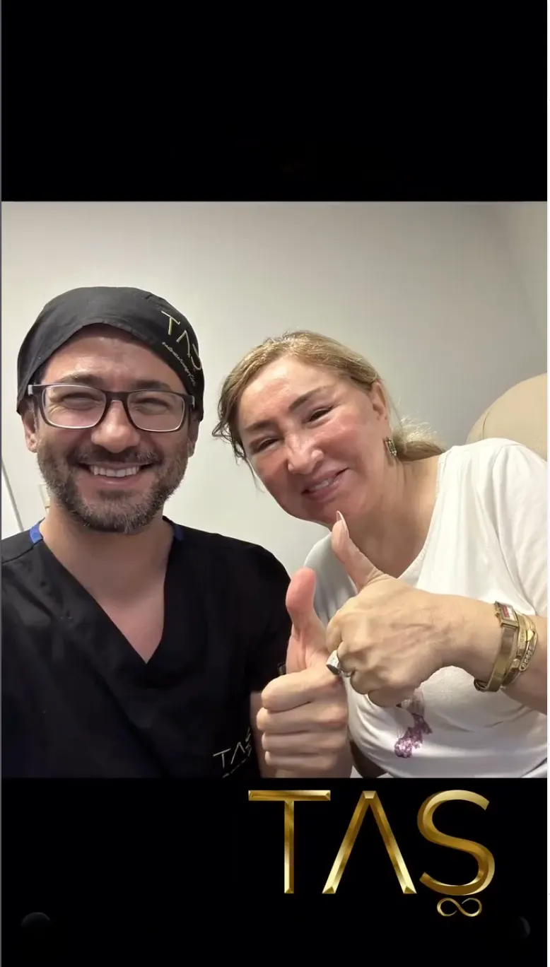 Suleyman Tas reviews – verified facelift patient review #38
