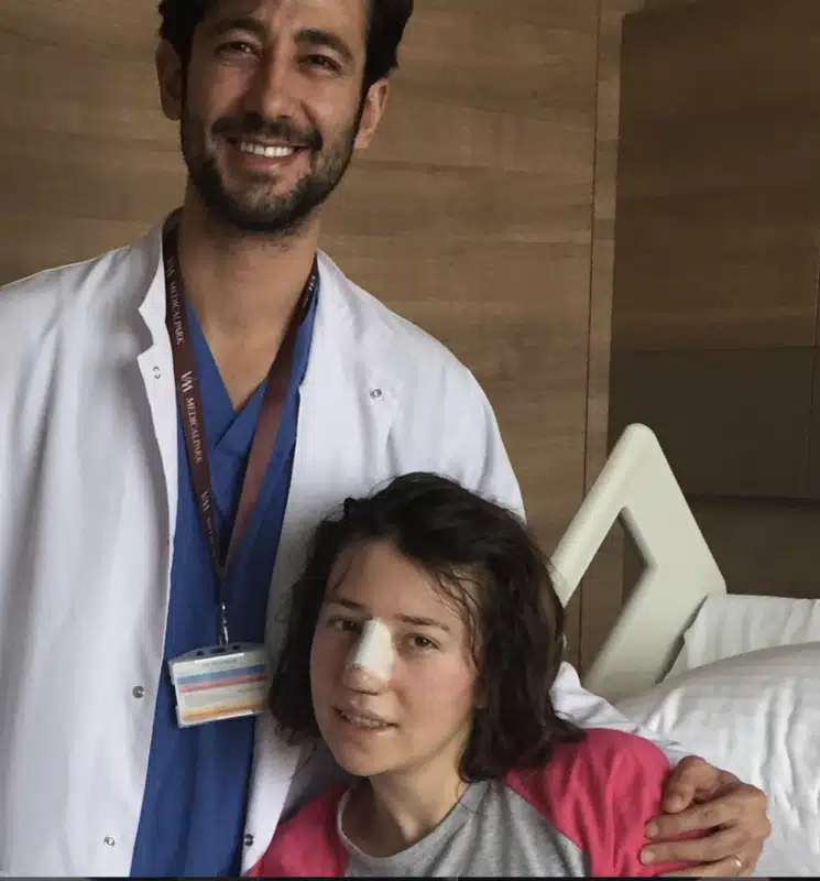 Suleyman Tas reviews – verified rhinoplasty patient review #380