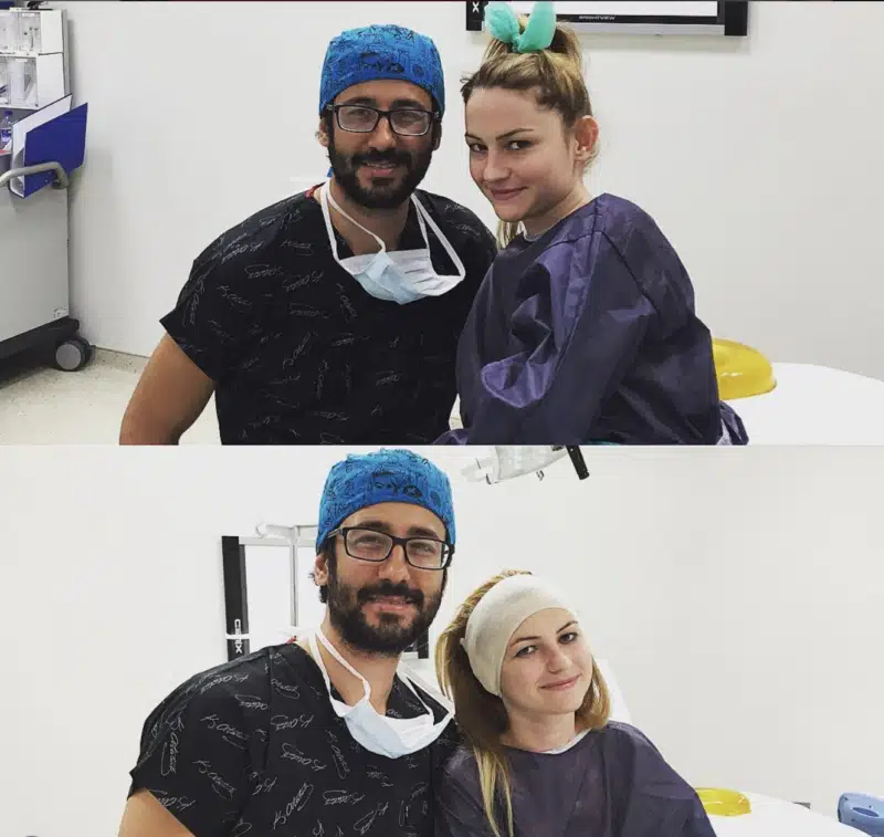 Suleyman Tas reviews – verified otoplasty patient review #325