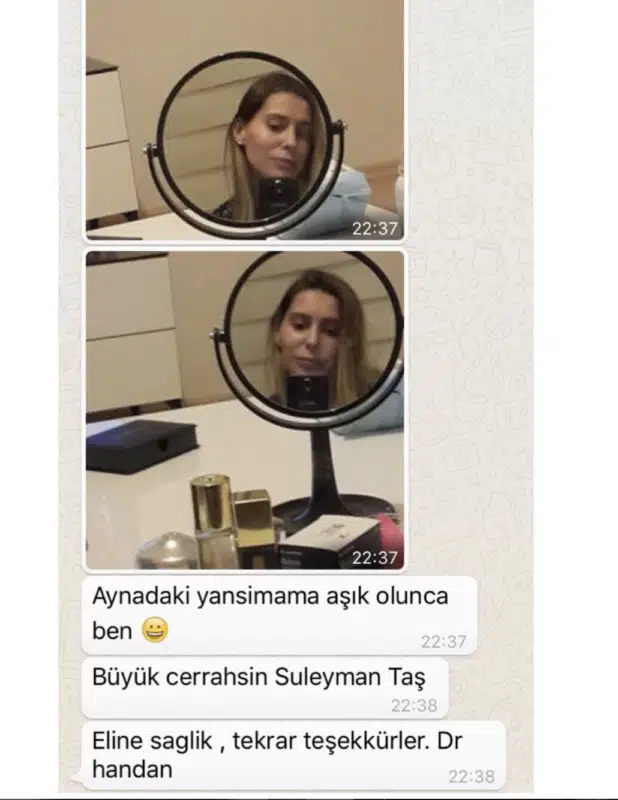 Suleyman Tas reviews – verified plastic surgery patient review #333