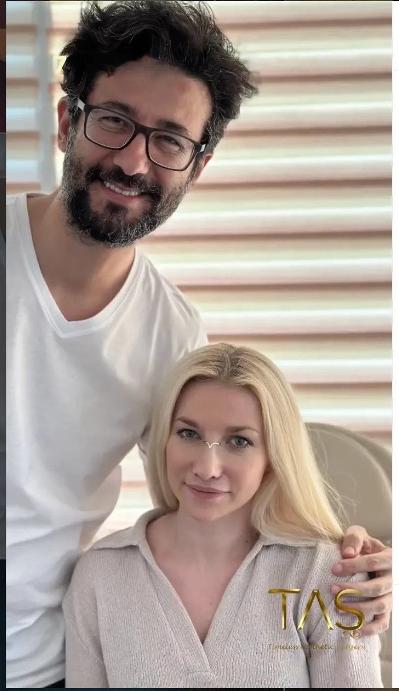Suleyman Tas reviews – verified rhinoplasty patient review #43 (photo 1)