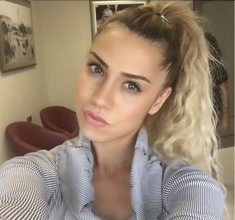 Suleyman Tas reviews – verified rhinoplasty patient review #251
