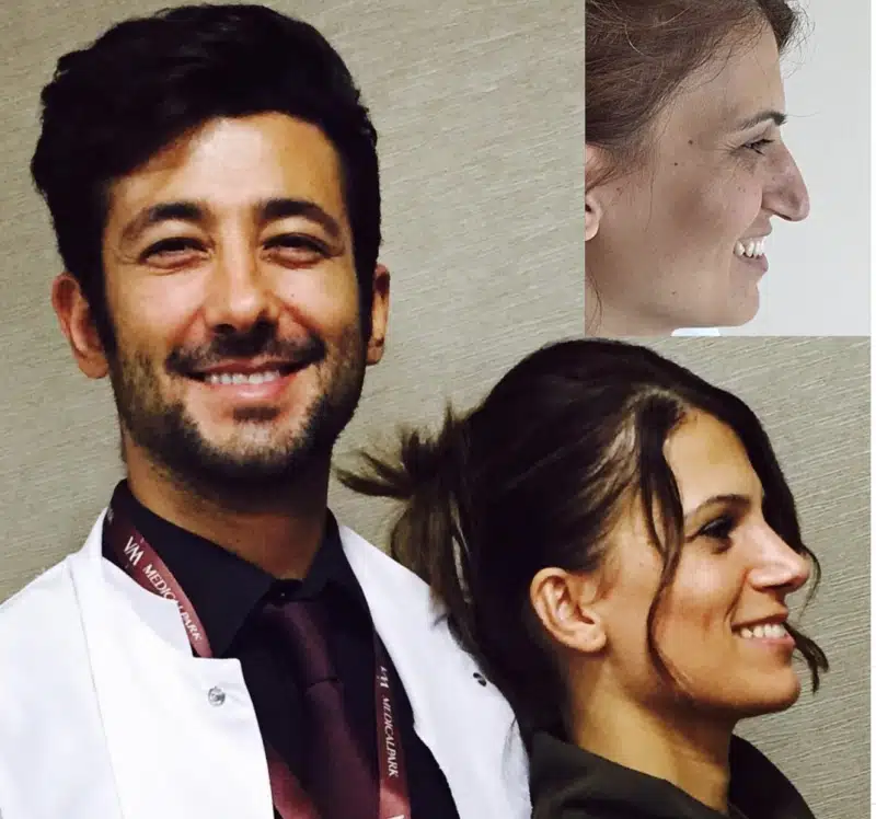 Suleyman Tas reviews – verified rhinoplasty patient review #389