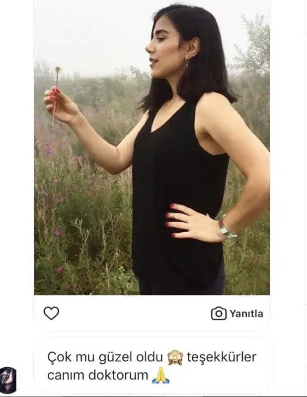 Suleyman Tas reviews – verified rhinoplasty patient review #212