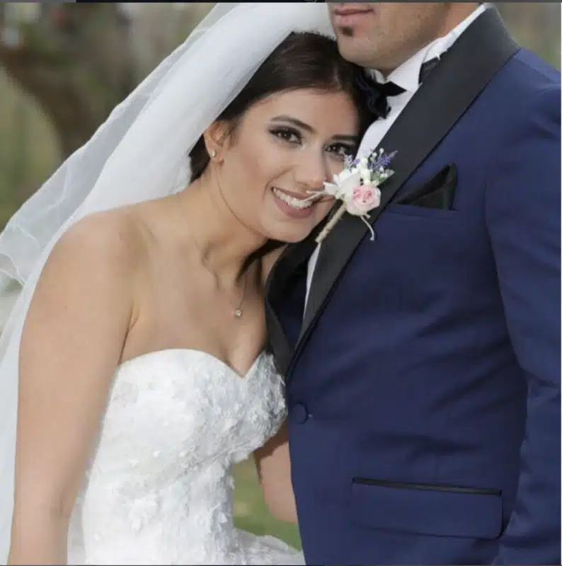 Suleyman Tas reviews – verified rhinoplasty patient review #221
