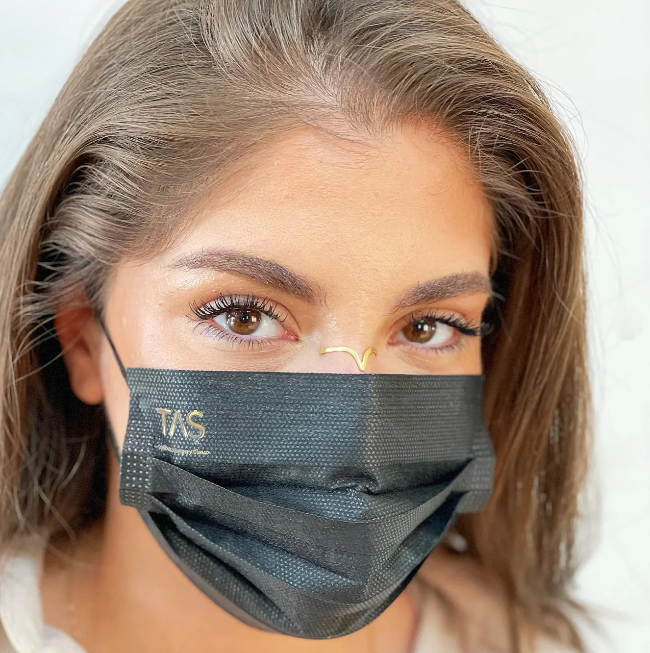 Suleyman Tas reviews – verified rhinoplasty patient review #75 (photo 1)