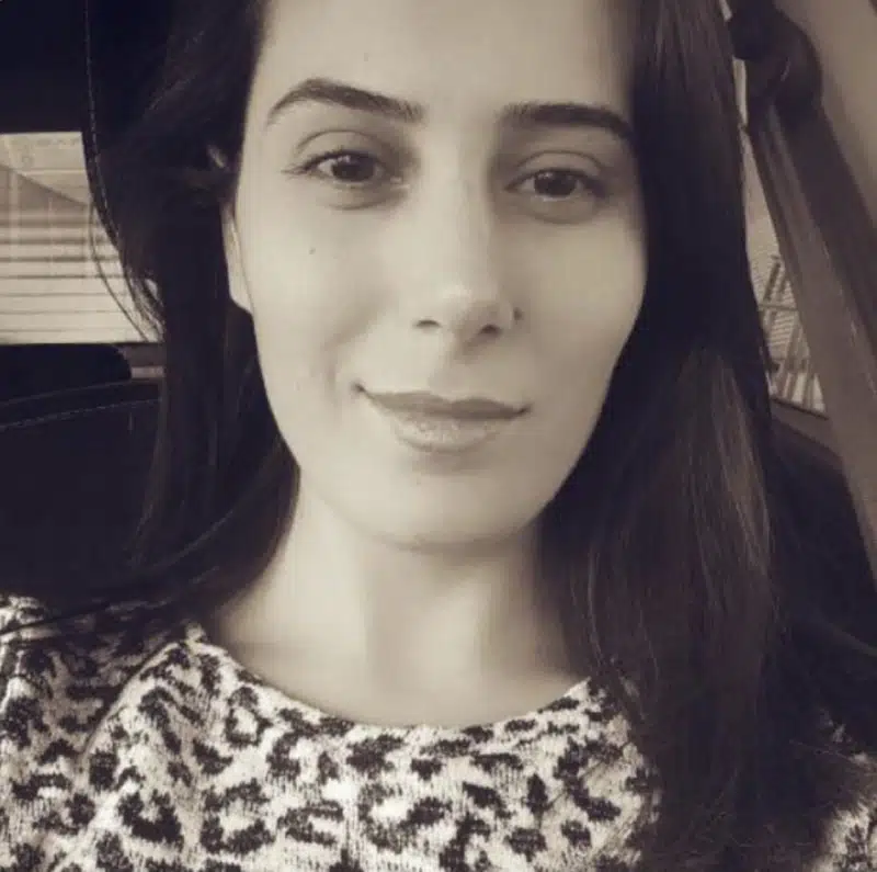 Suleyman Tas reviews – verified rhinoplasty patient review #370