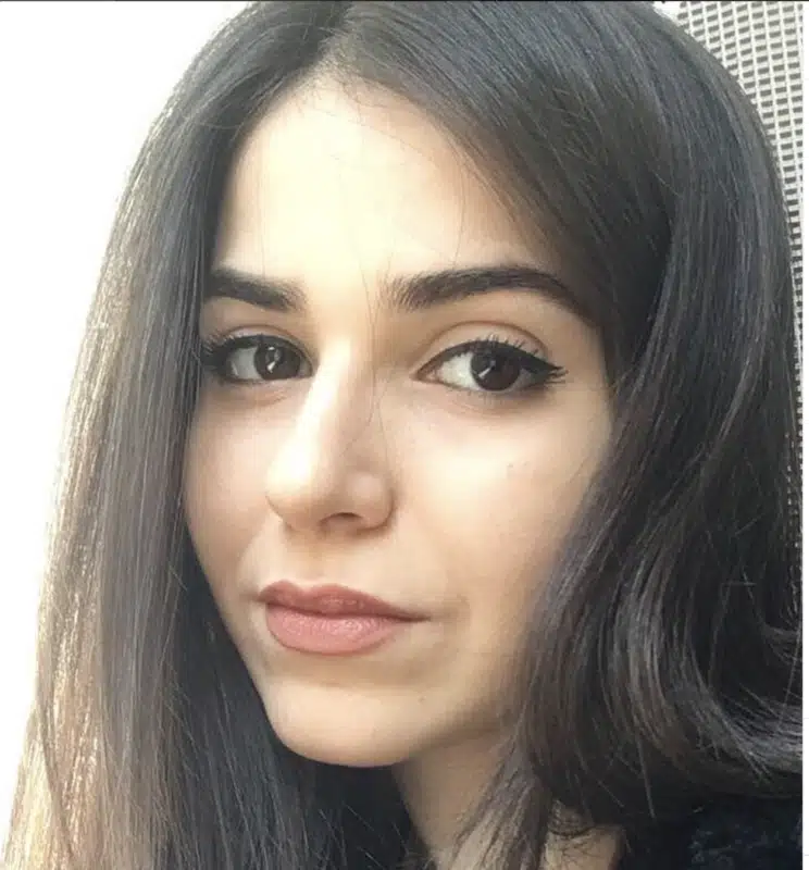 Suleyman Tas reviews – verified rhinoplasty patient review #231