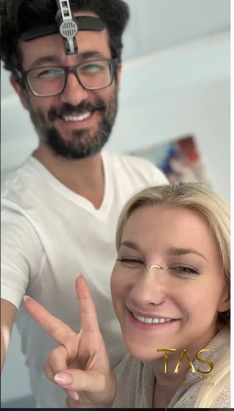 Suleyman Tas reviews – verified rhinoplasty patient review #43 (photo 2)