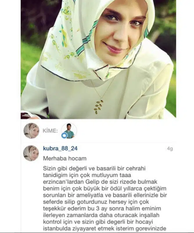 Suleyman Tas reviews – verified rhinoplasty patient review #400