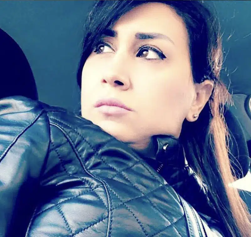 Suleyman Tas reviews – verified rhinoplasty patient review #247