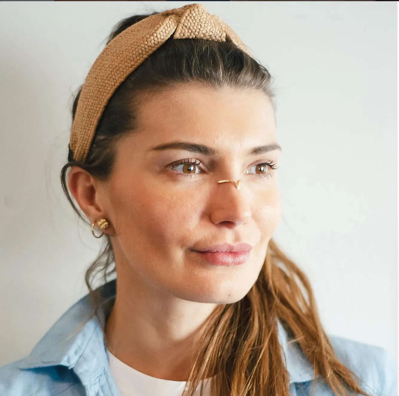 Suleyman Tas reviews – verified rhinoplasty patient review #76 (photo 3)