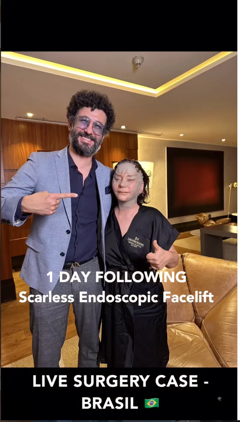 Suleyman Tas reviews – verified facelift patient review #7 (photo 3)