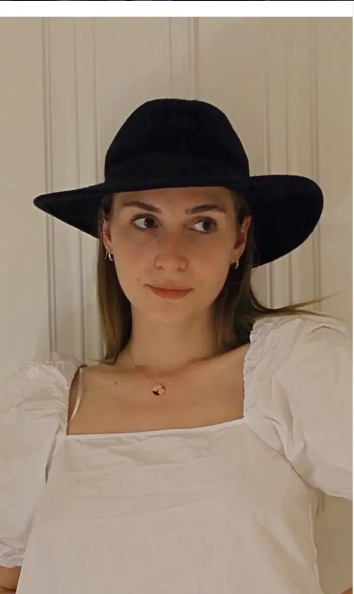 Suleyman Tas reviews – verified rhinoplasty patient review #155 (photo 2)