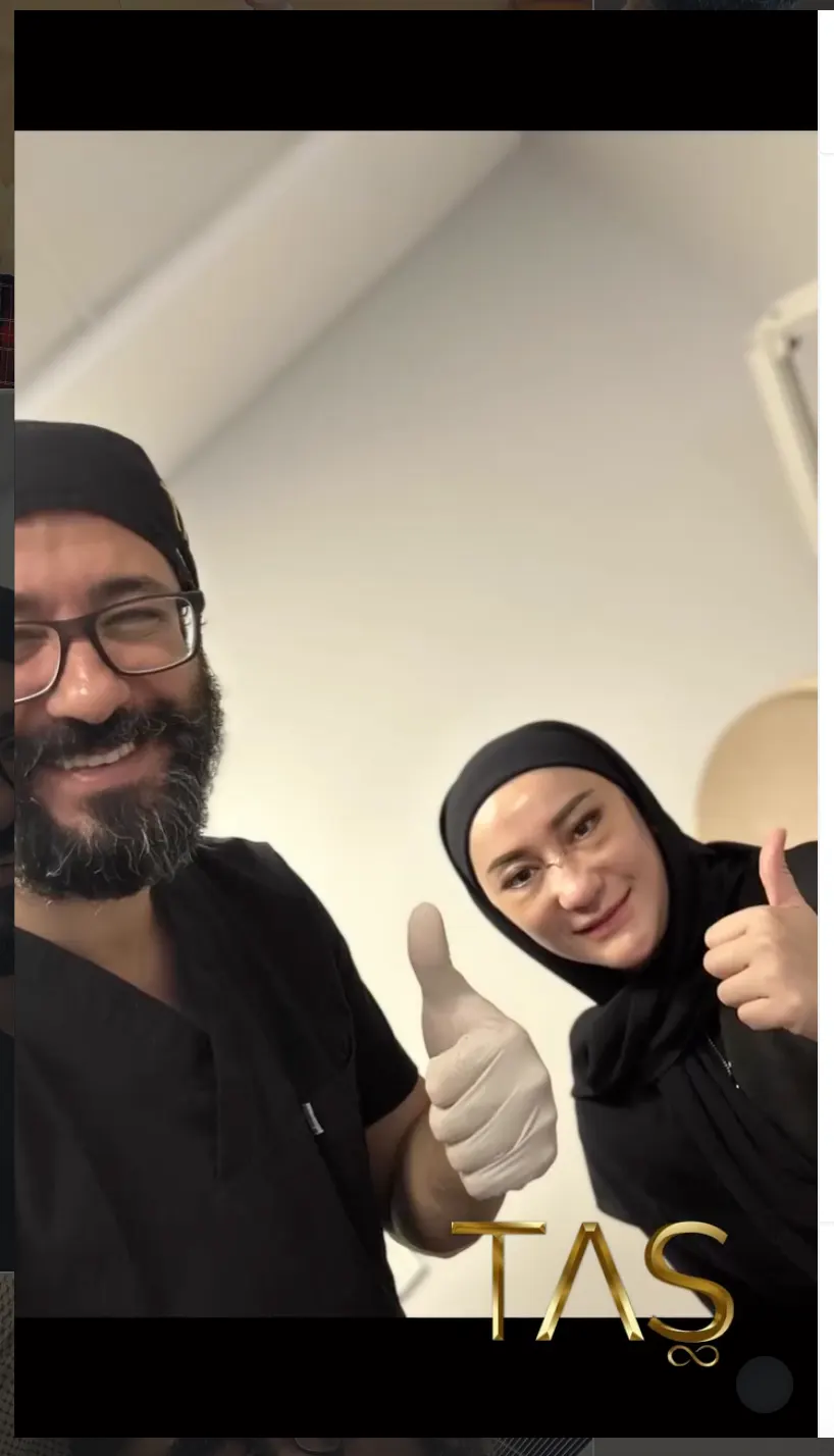 Suleyman Tas reviews – verified rhinoplasty patient review #23