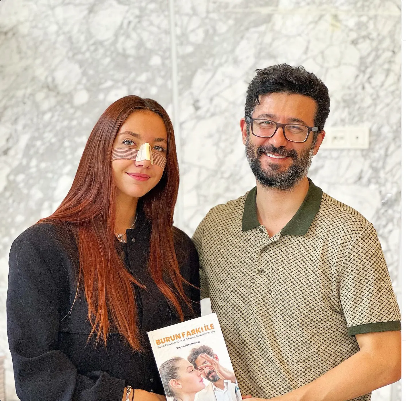 Suleyman Tas reviews – verified rhinoplasty patient review #30