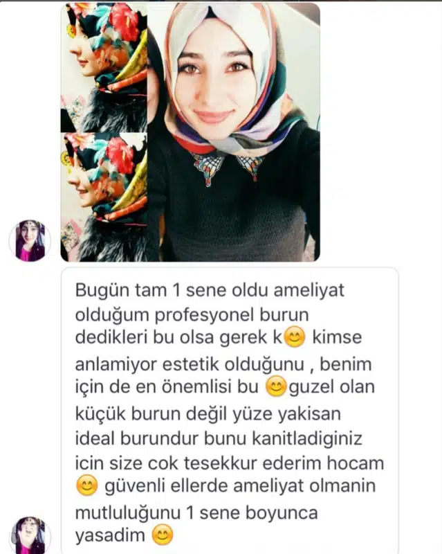Suleyman Tas reviews – verified rhinoplasty patient review #339