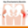hip-bursitis_choosept_illustrati.jpg