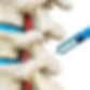 Facet-injection.jpg