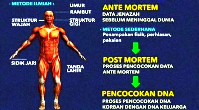 009784700_1420006575-Antemortem.jpg