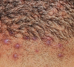 Ontwerp zonder titel (32).png