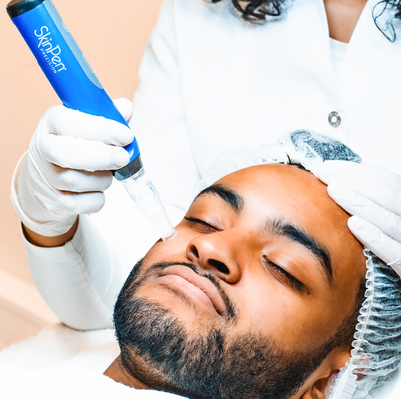 Skinpen microneedling rijswijk den haag