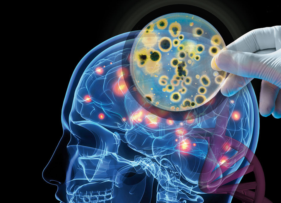 Infecciones neurológicas