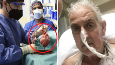 מושתל לב החזיר הראשון התגלה כאסיר שהשתחרר!!! (סיפור מטורף)