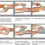 Thumbnail: Israeli Emergency Bandage (T3 or First responder)