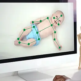 Kliniker och forskare vid St Olavs hospital och NTNU kan upptäcka hjärnskador och cerebral pares i ett tidigt skede genom observation av spädbarns spontana rörelser. CheckWare för att skicka videoinspelningar till experter med specialisterfarenhet från kliniska undersökningar.