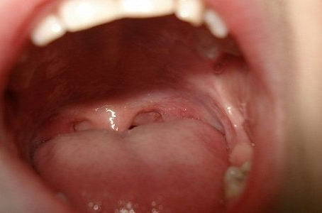 Forget Peppermint Candies: This Recipe “KILLS” EVERY BAD BREATH!