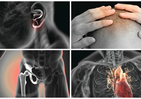 4 Silent Signs You May Have Clogged Arteries and How to Unclog Them Naturally