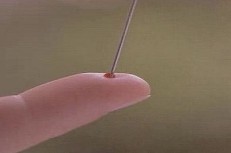 Here’s How to Save Your or Someone Else’s Life From Stroke Using Only a Needle