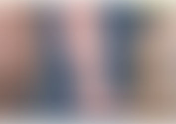 3 Amazing Home Remedies To Treat Varicose Veins Naturally