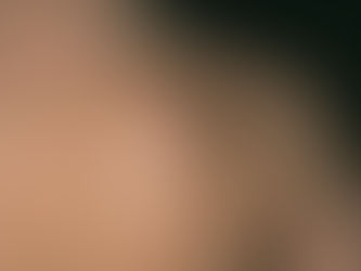 Recipe For Naturally Removing Adipose Tissue, Lipoma, Within 8 Days!