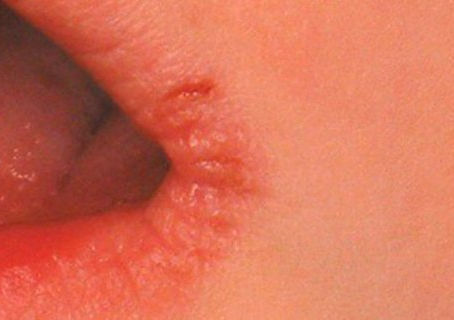 Do You Have Any of These 5 Symptoms? Make sure, These are Signs That Hint of Something Bad