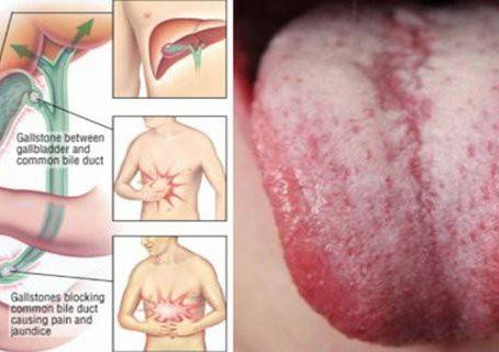 10 Warning Symptoms To Remind You It’s Time to Flush Toxin Out of Your Body!