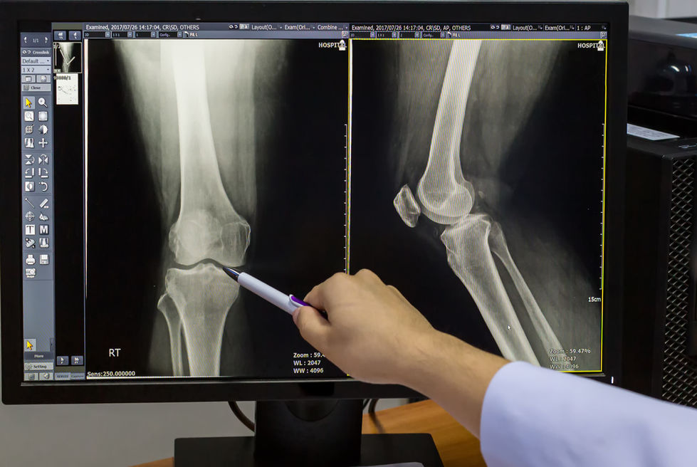 doctor-pointing-on-the-knee-problem-point-on-x-ray-2023-11-27-05-01-01-utc
