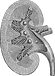 Kidney Crop.png