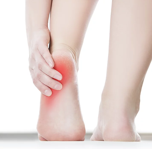 Heel Pain at Instride Capital Foot and Ankle Centers. Dr. Eldon Peters, Raleigh Podiatrist.