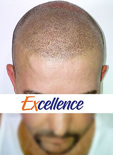 pigmentação capilar 3d topik _ excellence - 9.jpg