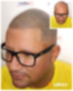 micropigmetacao_capilar_3D_belo_horizonte_03