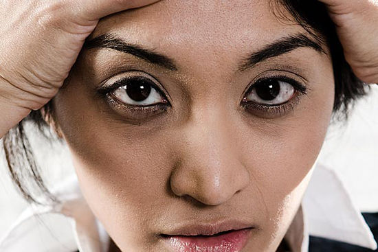 ojeras-1.jpg