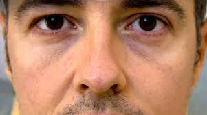 ojeras 2.jpg